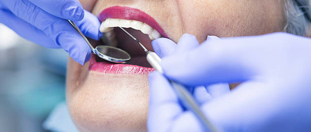 Best Emergency Broken Tooth Repair in Mount Pleasant, PA